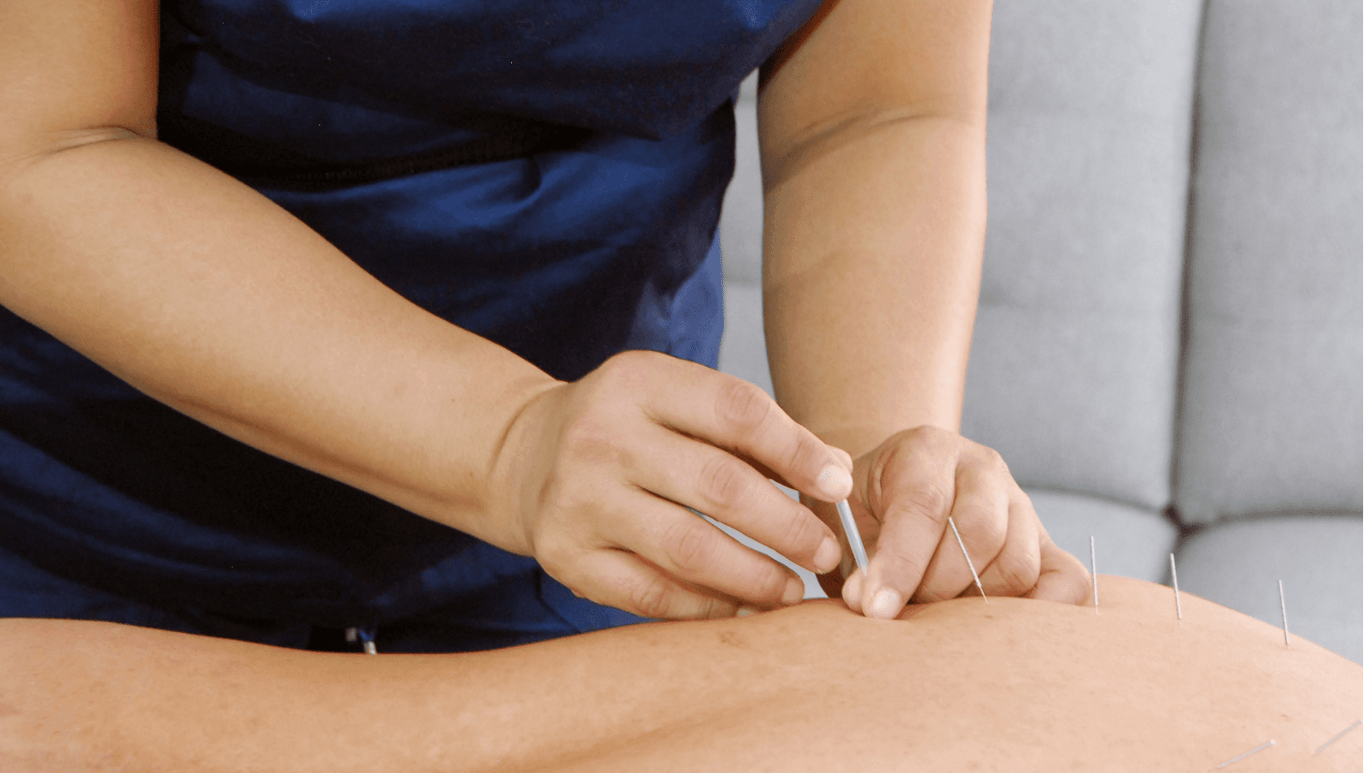 Image for Massage Therapy with Medical Acupuncture